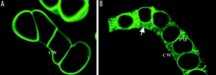 Confocal laser scanning microscope images