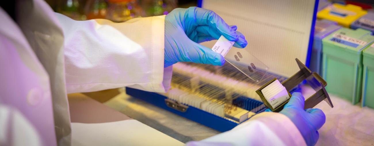 Person holding lab slides